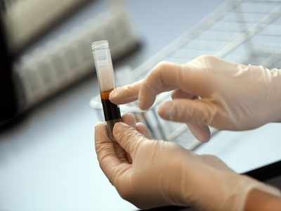 Curious case of COVID-19 patient: Asymptomatic Vadodara youth tests positive for virus seven times in a month