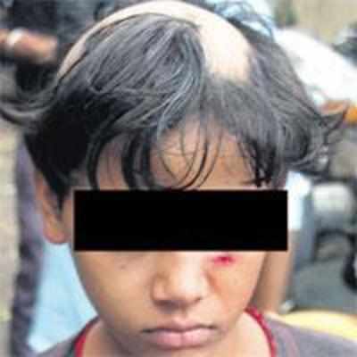 11-yr-old bashed up, partially tonsured for stealing an egg