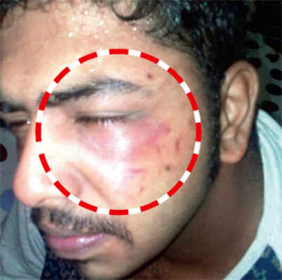 19-year-old beaten up by Kandivali highrise residents for smoking in front of the building