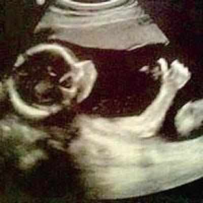 All's well Ma! Baby gives thumbs-up sign in scan