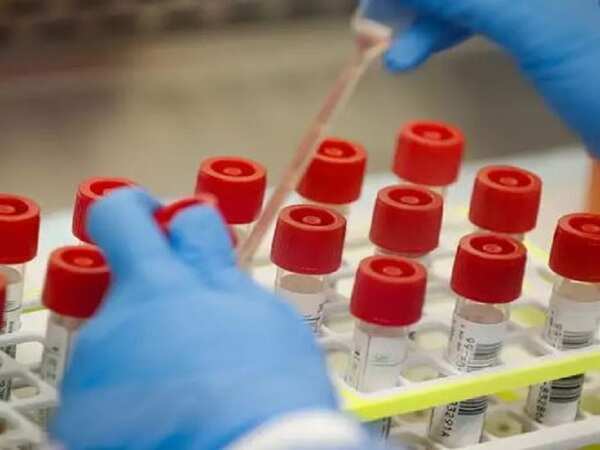 Covid-19: Random testing begins in Kannur