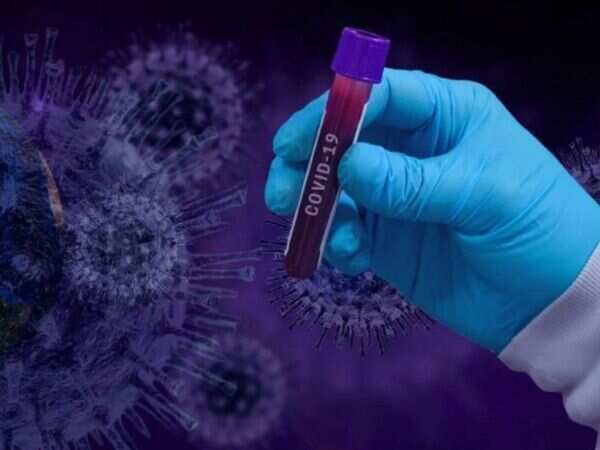 Two passengers from Mumbai test positive for Covid-19 at Indore airport