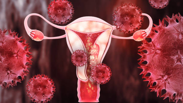 Cervical cancer claims over 3.5 lakh lives every year: Doctor shares common healthy habits that can reduce the risk