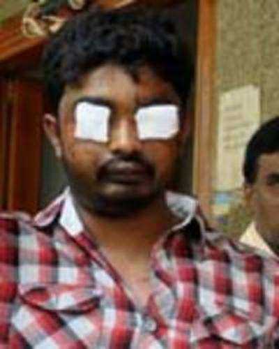 Man has eyes gouged out by bride's brother