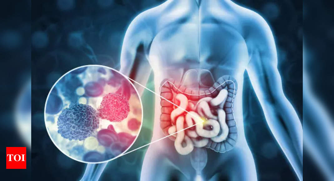 bowel-cancer-symptoms-bowel-cancer-one-of-the-earliest-signs-of