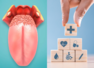 5 tastes in mouth signaling health problems