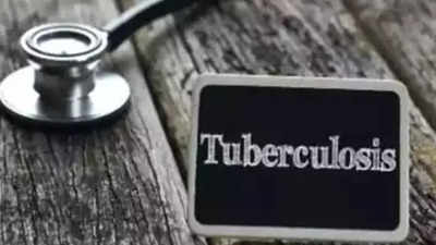 Special tuberculosis screening on third Mondays