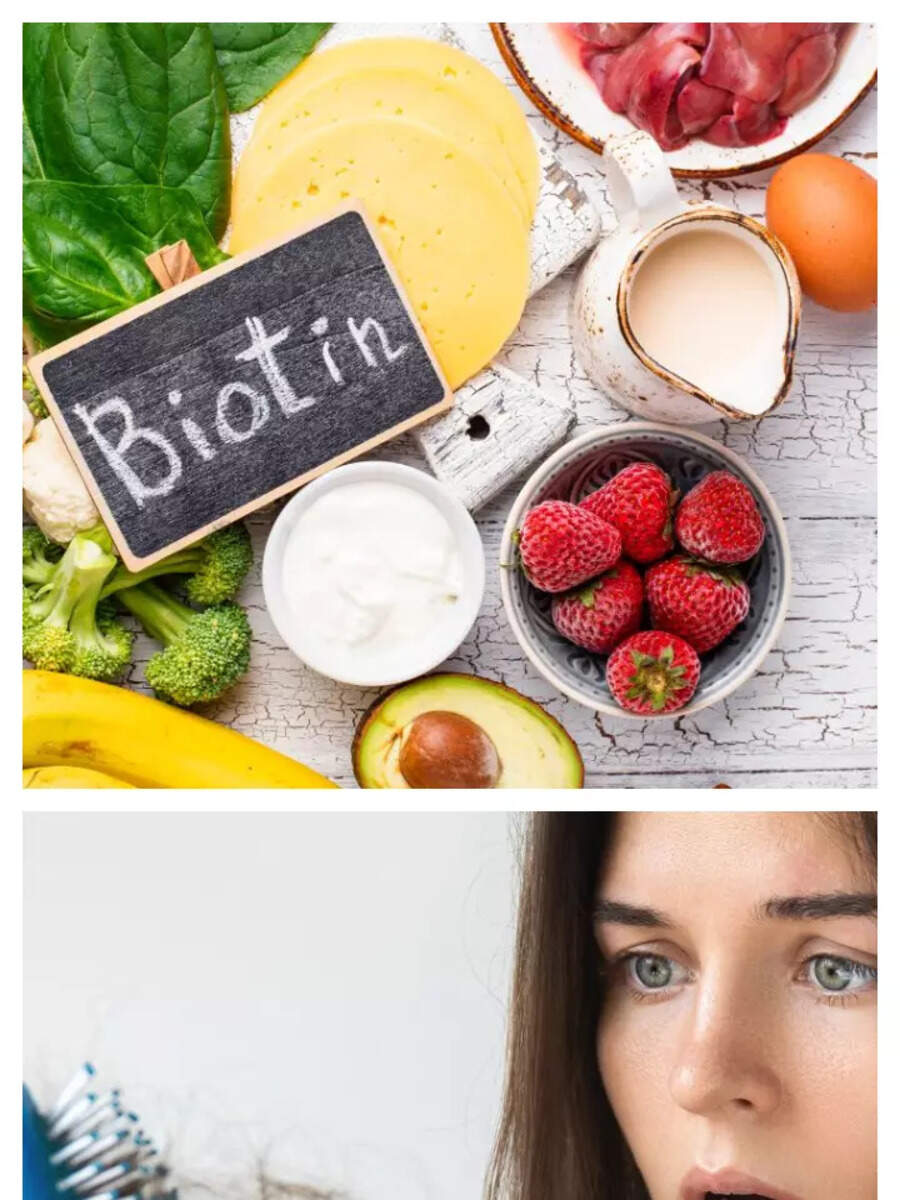Foods Rich In Biotin That Can Fix Hairloss Naturally Times Of India foods-rich-in-biotin-that-can-fix-hairloss-naturally-times-of-india