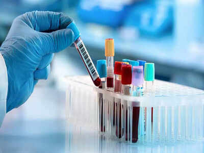 Cholesterol, diabetes and more: Complete guide on which test detects what health issue