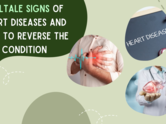 Telltale signs of heart diseases and how to reverse the condition