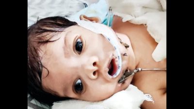 Born with rare deformity, infant gets new life, courtesy Command Hosp ...