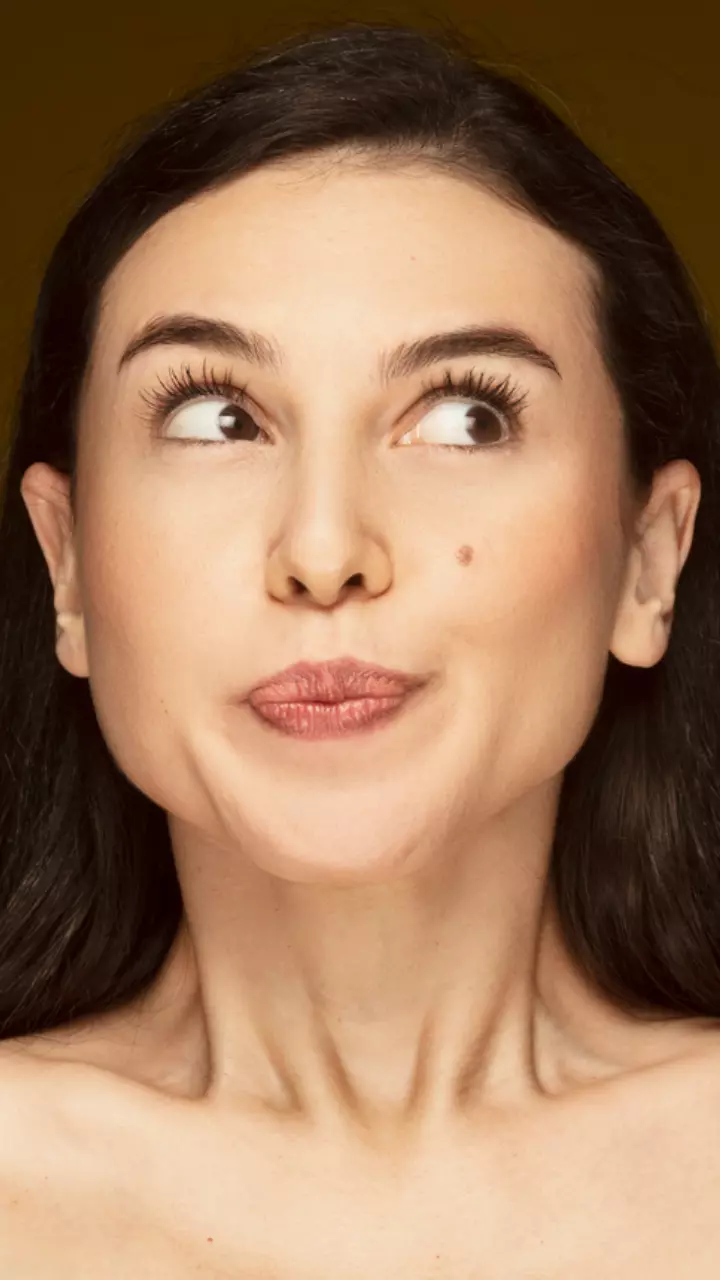 10 home remedies to lighten moles Times of India