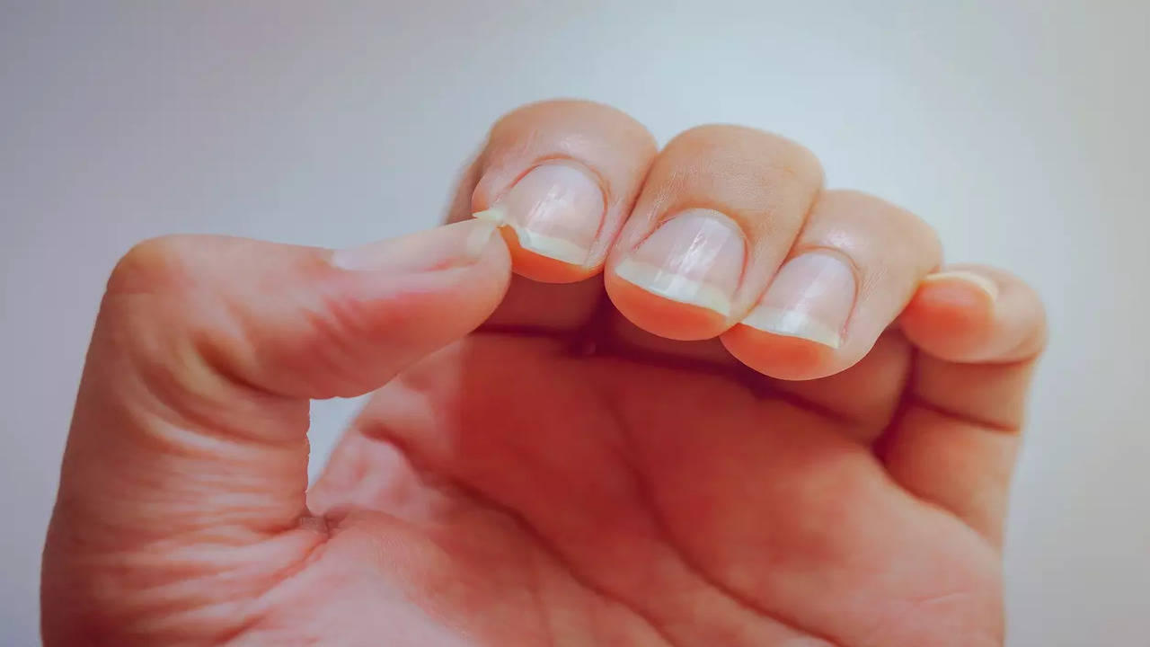 15 common nail conditions & how to deal with them – Scratch