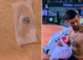 What is the device on Novak Djokovic's chest?