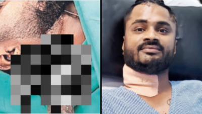 Navi Mumbai: Rusty knife in neck, man rides to hospital; lives to tell the tale