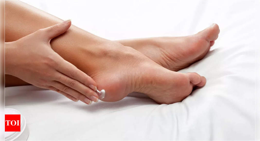 8 Proven Tips For Healing and Preventing Cracked Heels