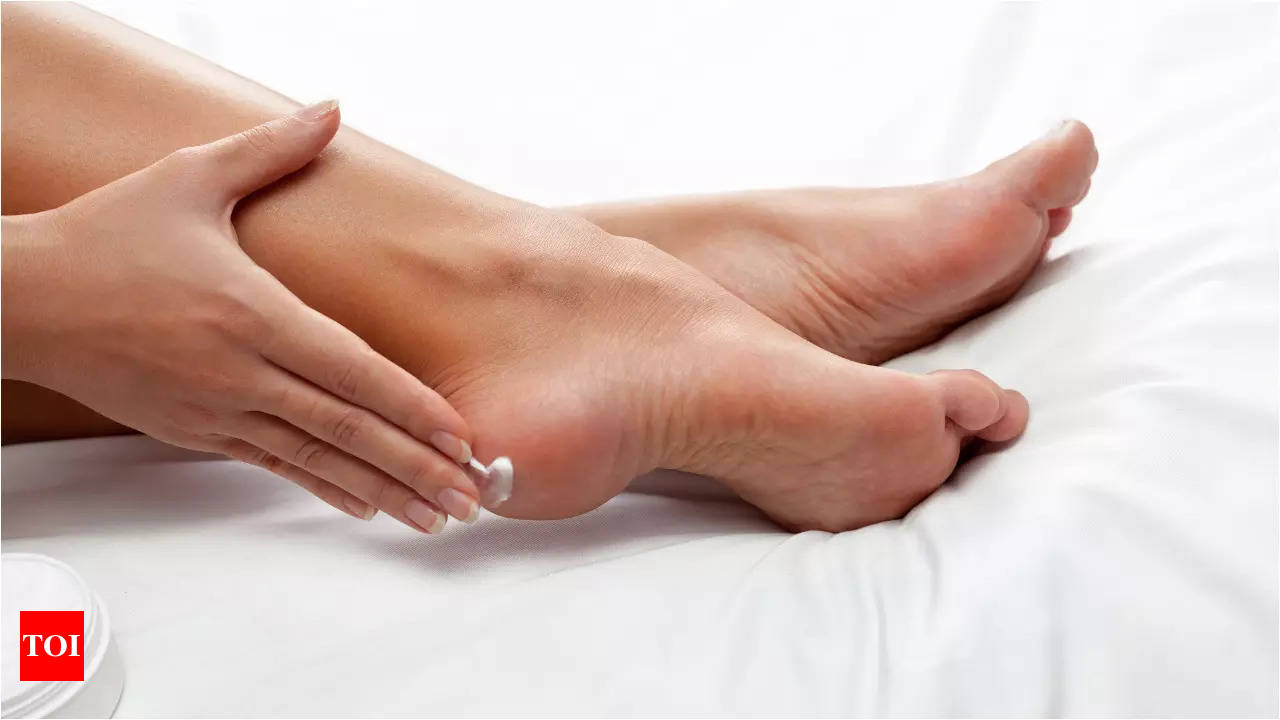 10 Simple Home Remedies For Cracked Heels - YouTube