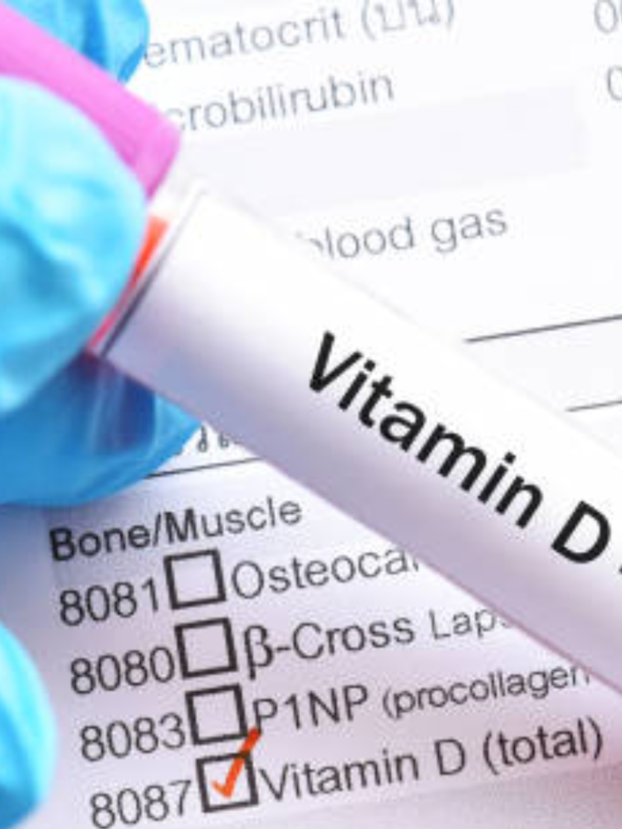 9 Signs and Symptoms of a Vitamin D Deficiency Times Now