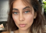 Anusha Dandekar on ovarian lump surgery
