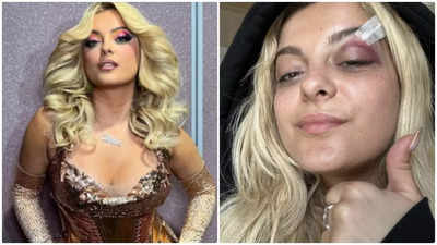 Singer Bebe Rexha says she's OK after being hit in the face on stage by thrown phone