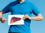Fatty liver cases rising: Know the reasons​