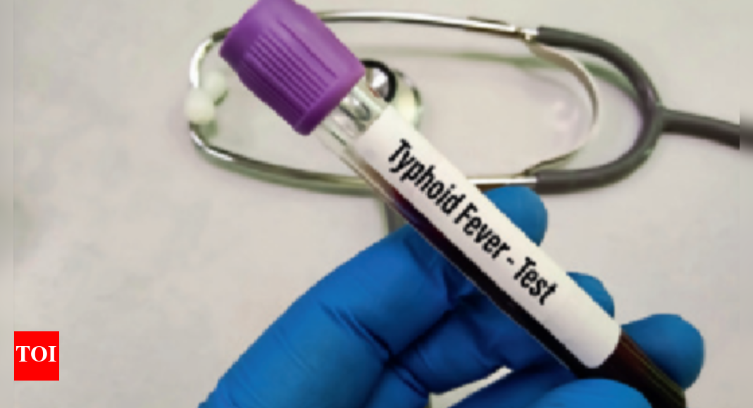 Amid surge in cases of typhoid, experts lay stress on vaccination | Lucknow News