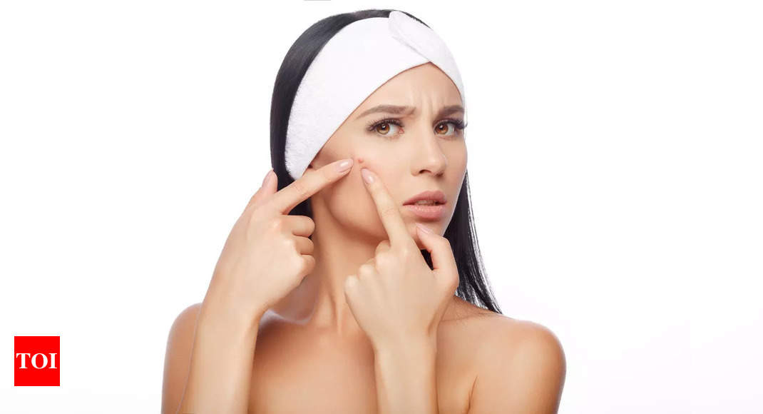 Skin Care Tips: 10 habits to keep pimples at bay – Times of India |