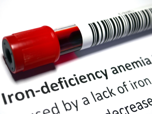 Iron Deficiency Symptoms: Nearly 1 in 4 girls and young women