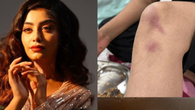 Udaariyaan's Twinkle Arora gets injured while performing a stunt on sets; continues to shoot post applying makeup on bruises