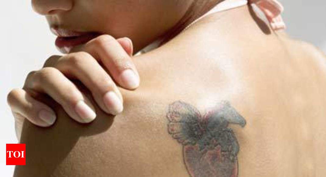 Top Tattoo Removal in Noida Sector 18 Delhi  Best Permanent Tattoo Removal   Justdial