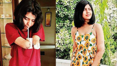 Against all odds: Asia’s 1st bilateral hand transplant girl now a student at IIM-Calcutta