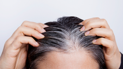 Is that 'safed baal' driving you crazy? Causes for premature greying of hair & expert solutions