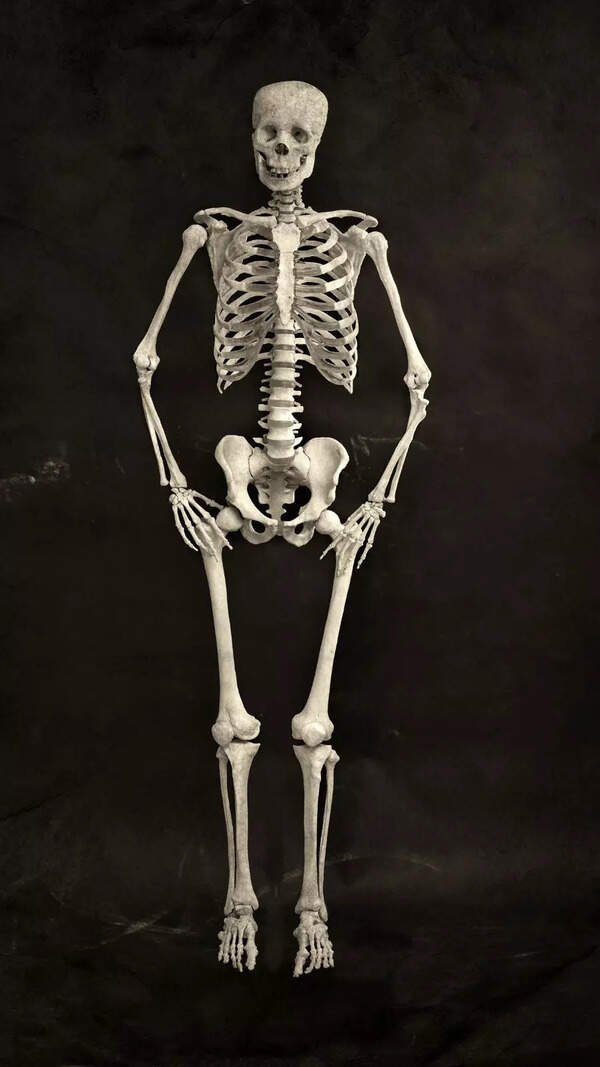 7 Early Symptoms of Weak Bones You Should Not Ignore