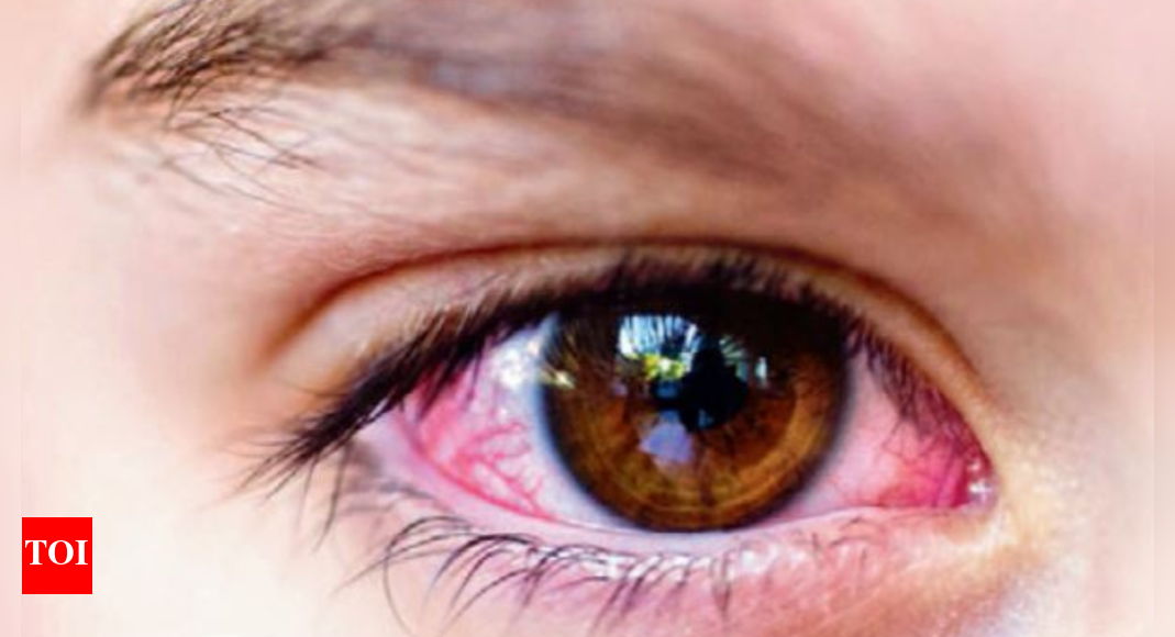Ophthalmology Society: Ophthalmology Soc Flags Illegal Sale Of Eye ...