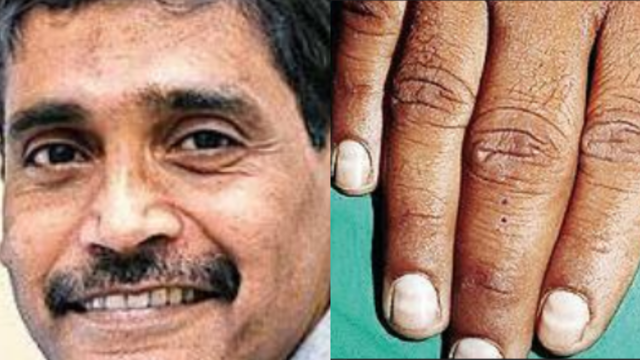 NAIL FINDINGS & ASSOCIATED CONDITIONS