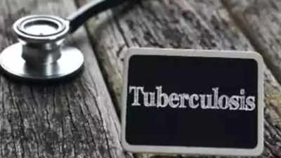 Modern lab to detect TB cases to open in Vimsar