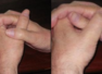How you cross thumbs can reveal your traits