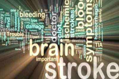 Lifestyle awareness: Understanding brain stroke