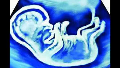 Doctors save 29-week-old foetus with severe anaemia