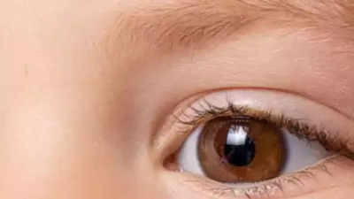 Intra-arterial chemo saves eyes and sight of 65% children with eye cancer at AIIMS
