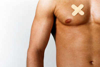 The untold truth about male breast cancer
