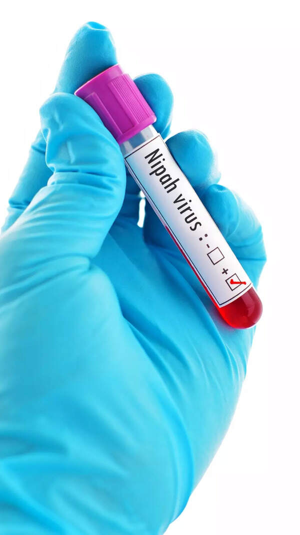 10 Nipah Virus Symptoms You Should Be Aware of