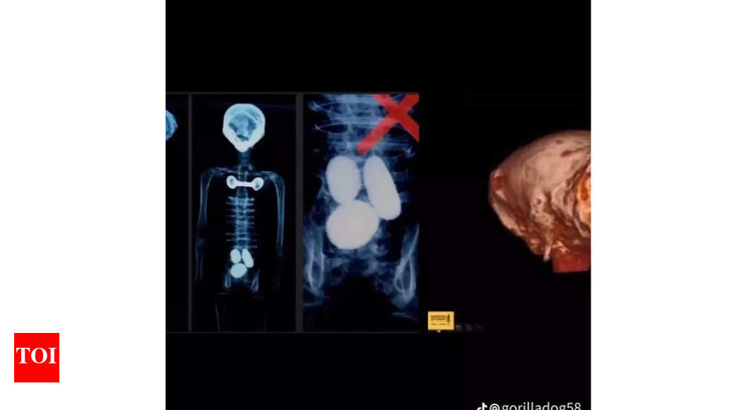 Mexico's alien bodies scanned, and here's what was found Times of India