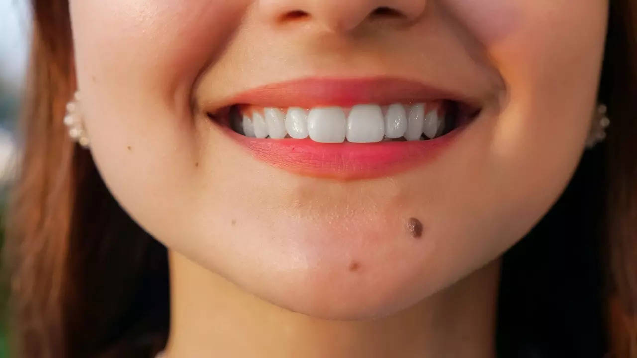 Meaning Of Moles On Face And Body That Reveal Your True Personality