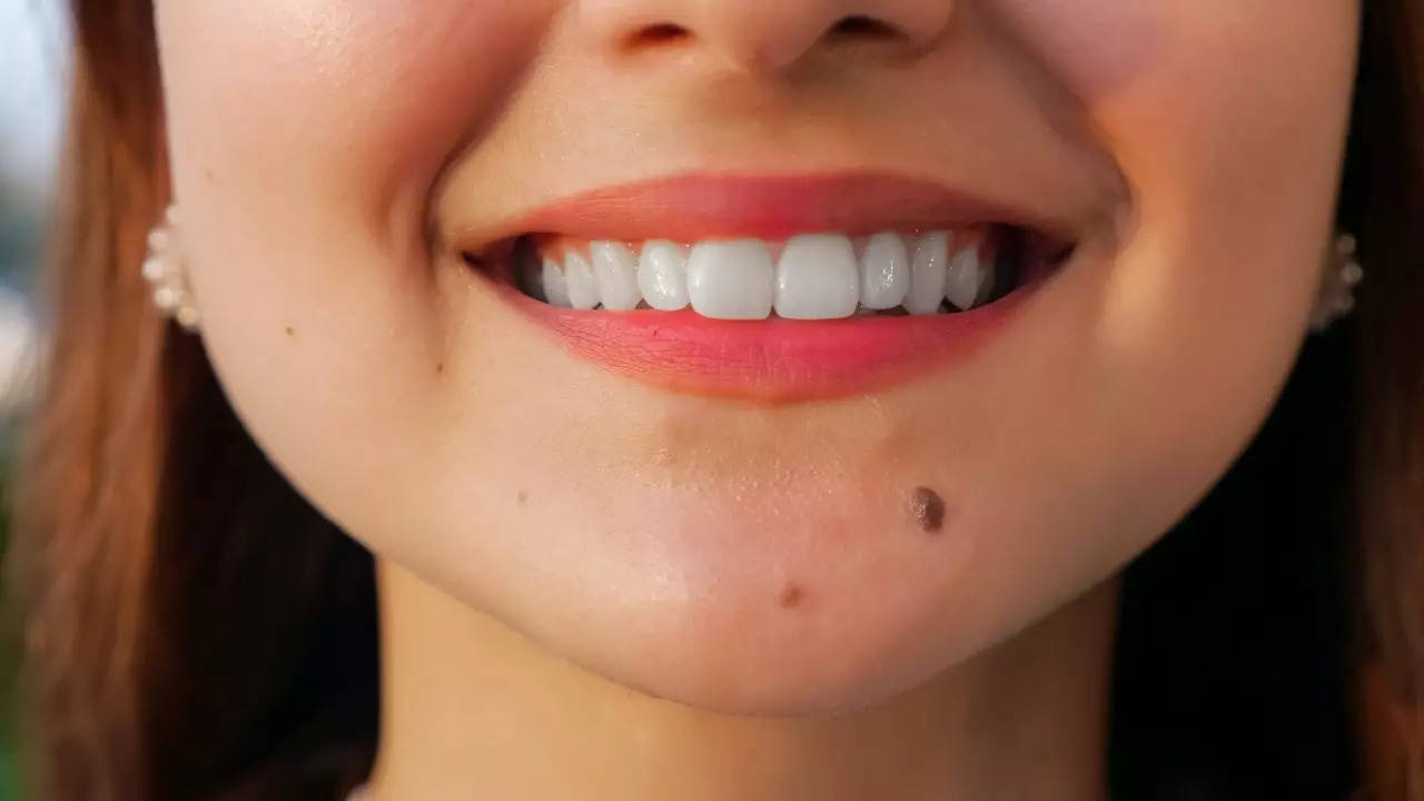 Your Face Moles Reveal About Your Personality 