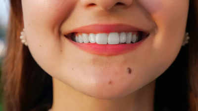 Meaning of moles on different parts of your face - Times of India