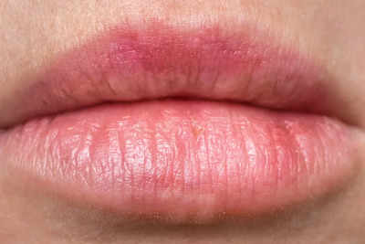 ​10 Home remedies to fix discolored lips