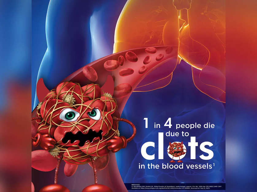 Blood clots in veins: Unmasking this silent threat on World Thrombosis Day