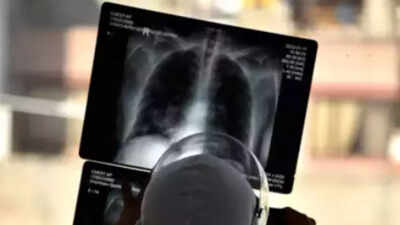 UK's heaviest man nearly sent to zoo as he was too big for human X-ray