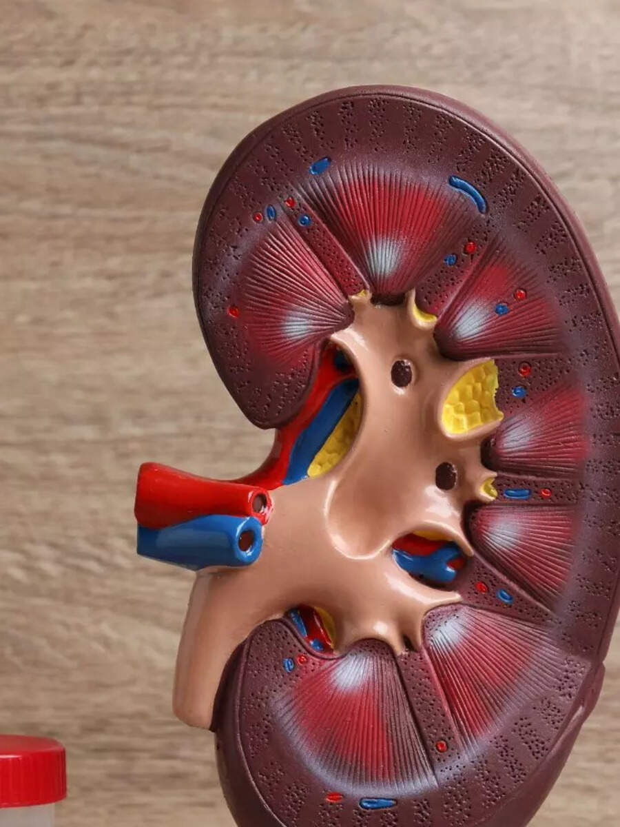 13 Superfoods to prevent kidney stones Times of India